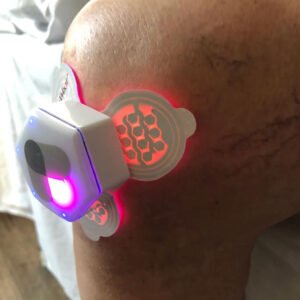 laser-1000x1000-knee